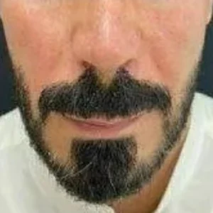 After
