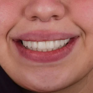 After