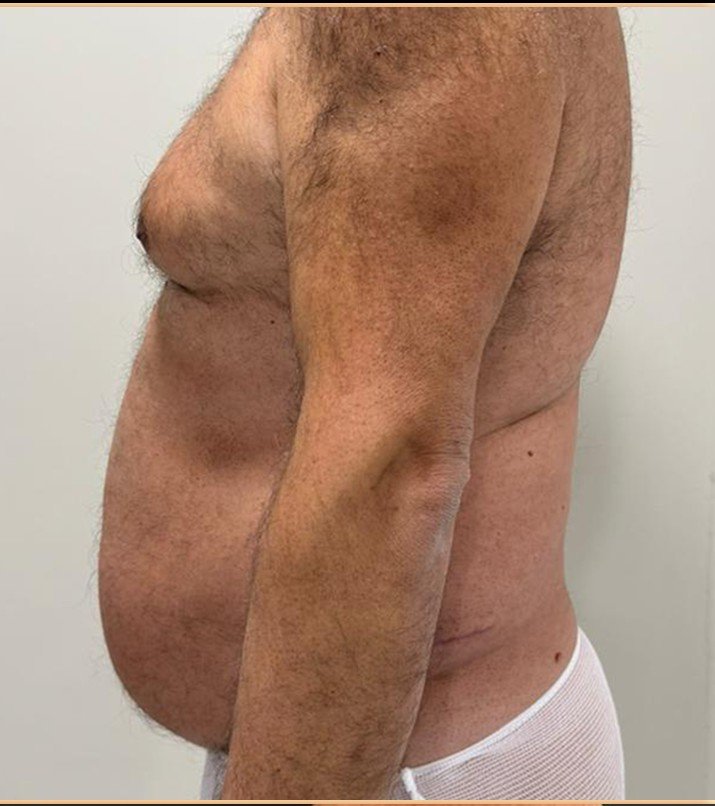 قبل — 3